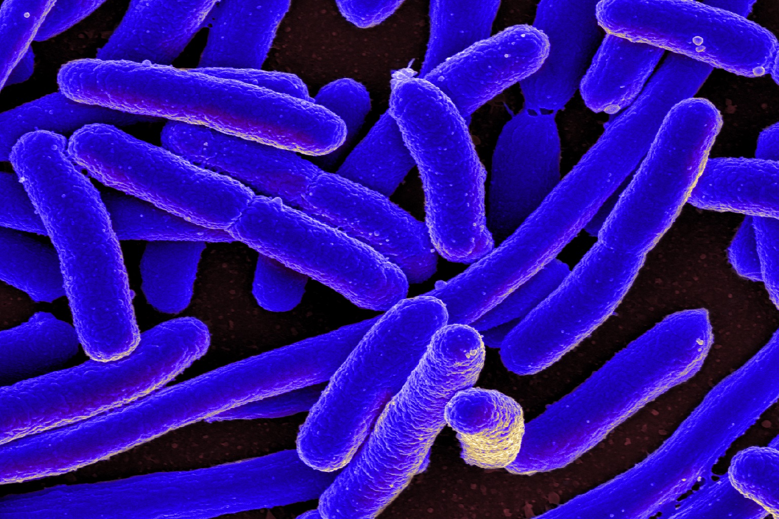 Scanning electron micrograph of Escherichia coli bacteria, commonly found in untreated wastewater.